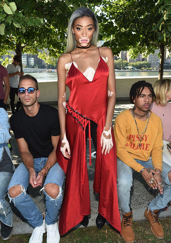 Winnie Harlow na fila A do desfile de Kanye West, em setembro (Foto: Getty Images)